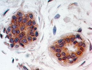 WFDC2 / HE4 Antibody (aa1-50)