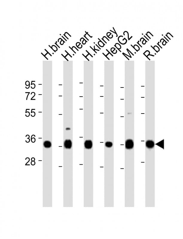 KCNMB2 Antibody (aa32-66)