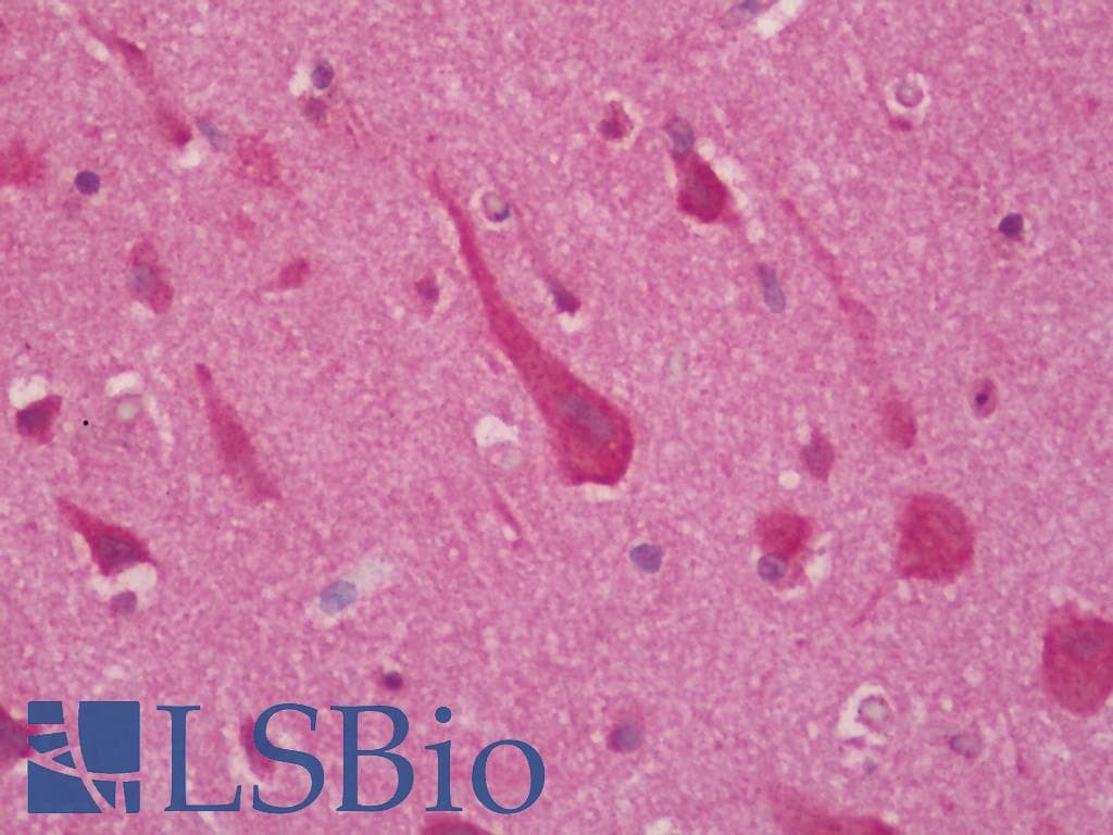 IHC-plus™ Polyclonal Rabbit anti-Human MAPT / Tau Antibody (IHC, WB)