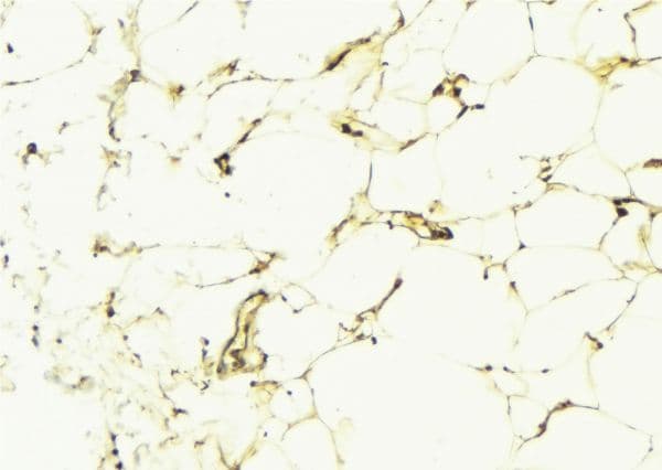 Polyclonal Rabbit anti-Human ADCY9 / Adenylate Cyclase 9 Antibody (IHC, WB)