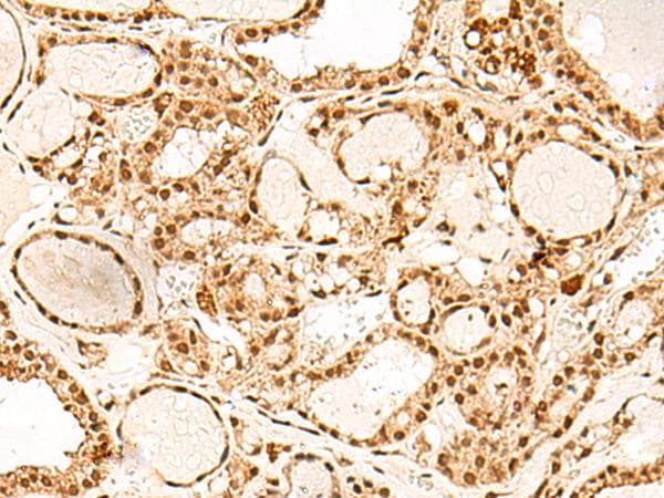 PD2 / PAF1 Antibody