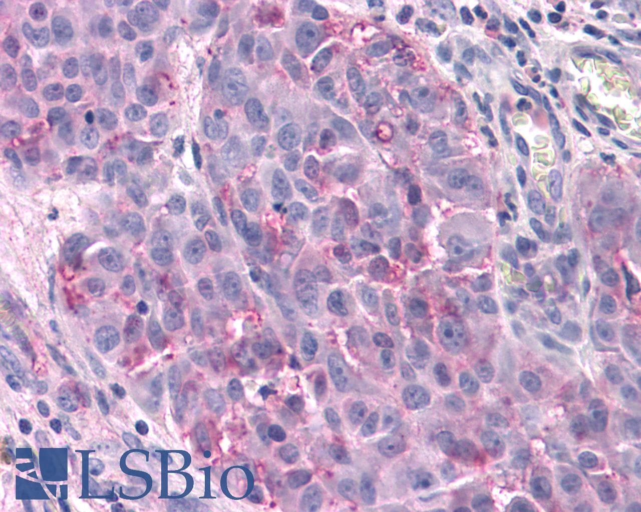 PathPlus™ Polyclonal Rabbit anti-Human T1R3 / TAS1R3 Antibody (N-Terminus, IHC)