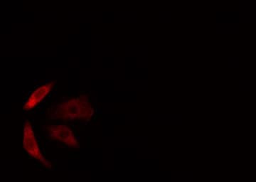 Polyclonal Rabbit anti-Human CDKAL1 Antibody (IF, WB)