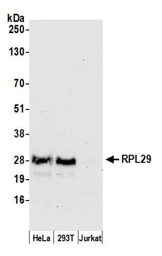 RPL29 / Ribosomal Protein L29 Antibody (aa1-50)