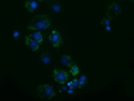 Monoclonal Mouse anti-Human AK3 / Adenylate Kinase 3 Antibody (clone OTI3G1, IHC, IF, WB)