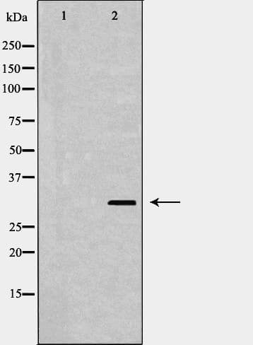 DCK / Deoxycytidine kinase Antibody