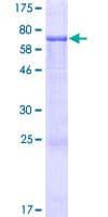 Human CIPC / KIAA1737 Protein (Recombinant GST)