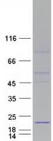 Human COX20 Protein (Recombinant Myc-DDK (Flag))
