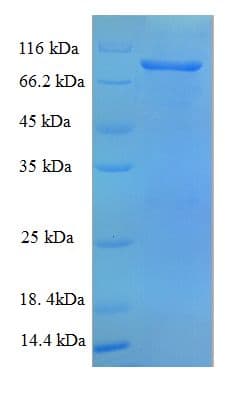 Rat VCAM1 / CD106 Protein (Recombinant 6His, N-terminus)