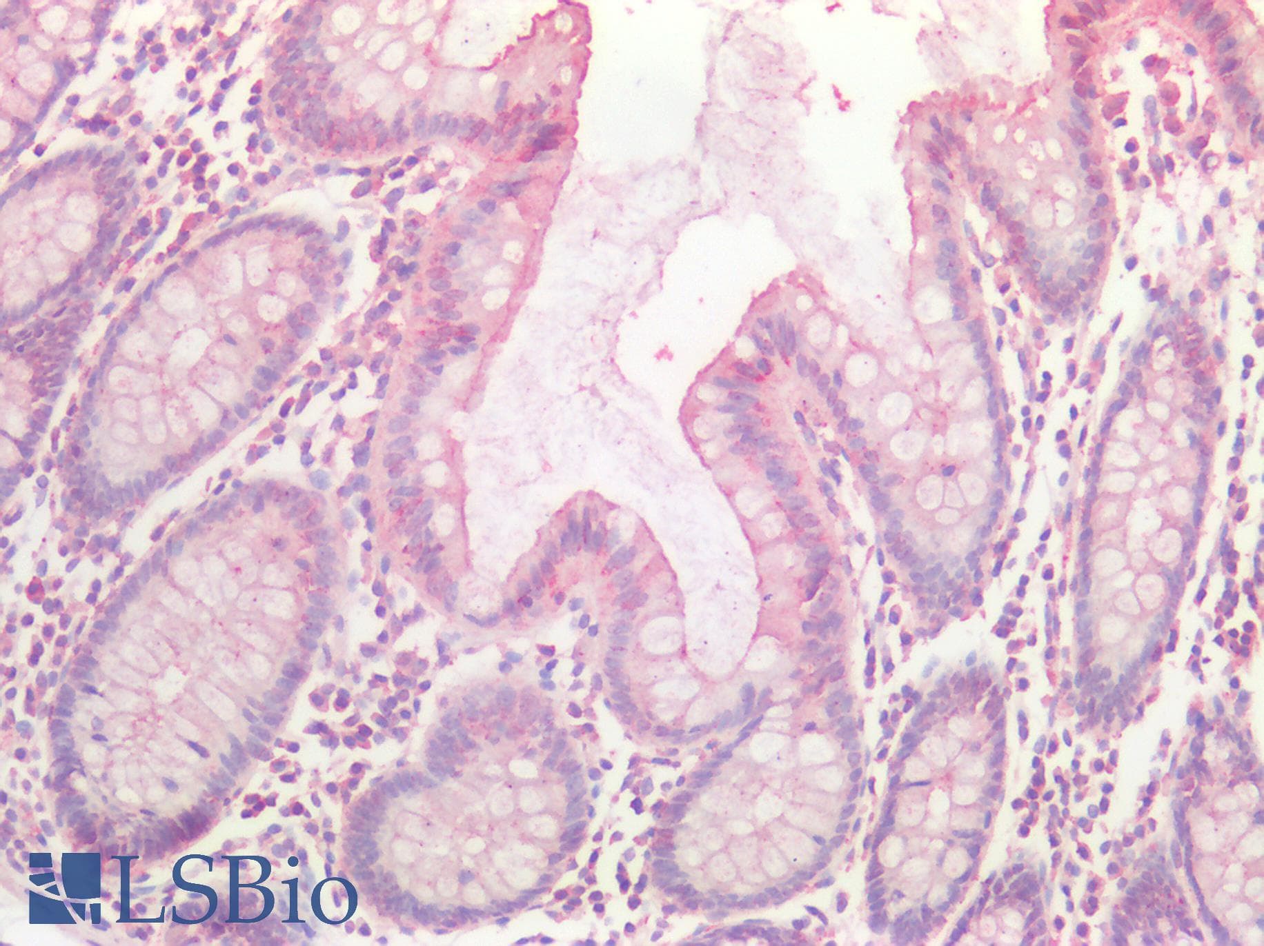 IHC-plus™ VIL1 / Villin Antibody (aa1-350)