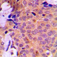 SAE2 / UBA2 Antibody (C-Terminus)