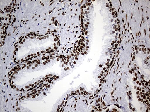 Monoclonal Mouse anti-Human HNRNPH1 / hnRNP H Antibody (clone OTI4F10, Carrier-free, IHC, WB)