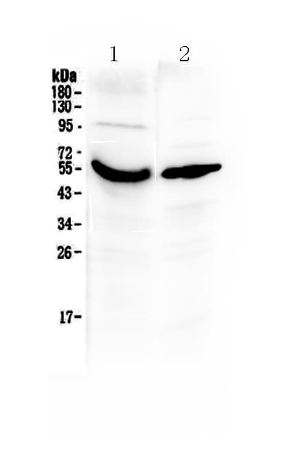 GC / Vitamin D-Binding Protein Antibody