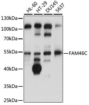 Polyclonal Rabbit anti-Human FAM46C Antibody (WB)