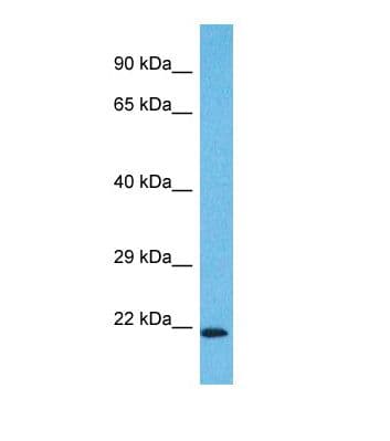 WDYHV1 Antibody (aa30-79)
