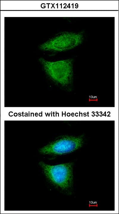 DYNC1I2 / IC2 Antibody (aa129-366)
