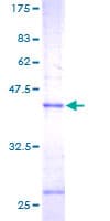 Human MGST1 Protein (Recombinant GST)