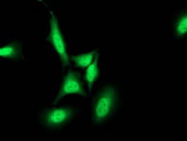 PNMT Antibody (clone OTI2A3)