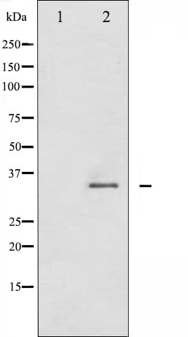 Polyclonal Rabbit anti-Human CDK2 Antibody (phospho-Thr160, IHC, IF, WB)