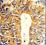 Polyclonal Rabbit anti-Human VIL1 / Villin Antibody (aa180-207, IHC, WB)