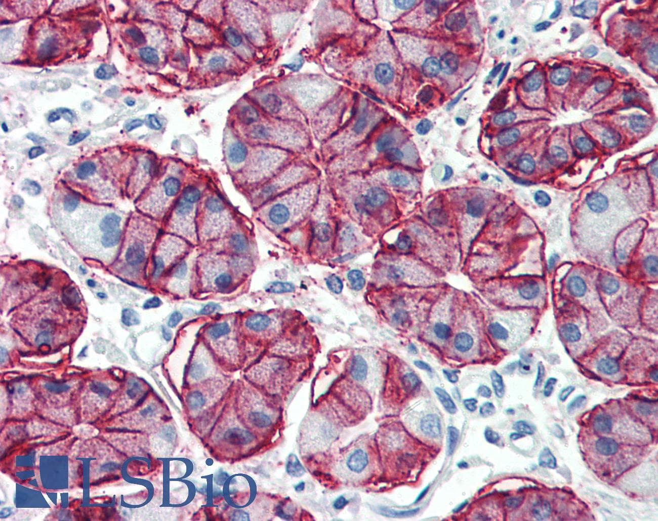 CA9 / Carbonic Anhydrase IX Antibody (C-Terminus, DY488)