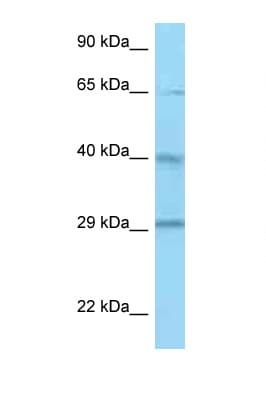 CFHR1 Antibody (aa183-232)