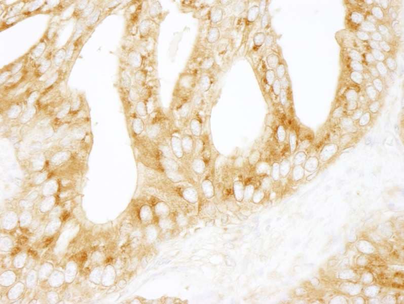 PRKAR2A Antibody (aa50-100)