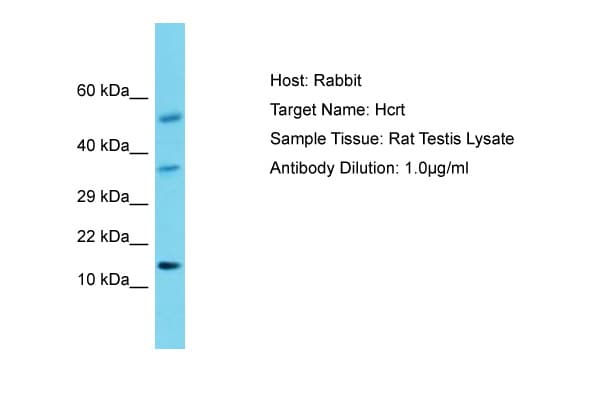 HCRT / Orexin Antibody (aa45-94)