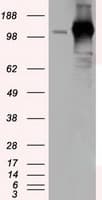 ERIC-1 / TACC3 Antibody (clone OTI1E4)