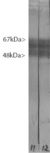 PathPlus™ MAPT / Tau Antibody (clone MCA-2E9)