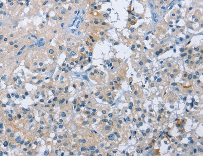 BTN2A2 Antibody