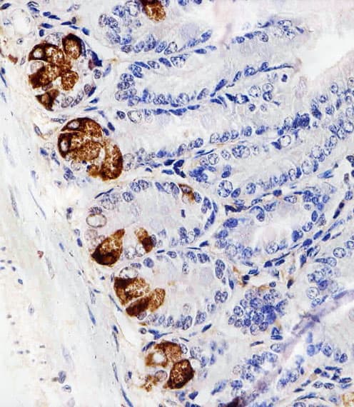LYZ / Lysozyme Antibody (aa119-154)