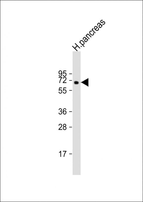 Polyclonal Rabbit anti-Human MGAT4B Antibody (aa32-62, WB)