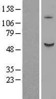 B3GALNT2 Protein (Over-Expression Lysate Myc-DDK (Flag))