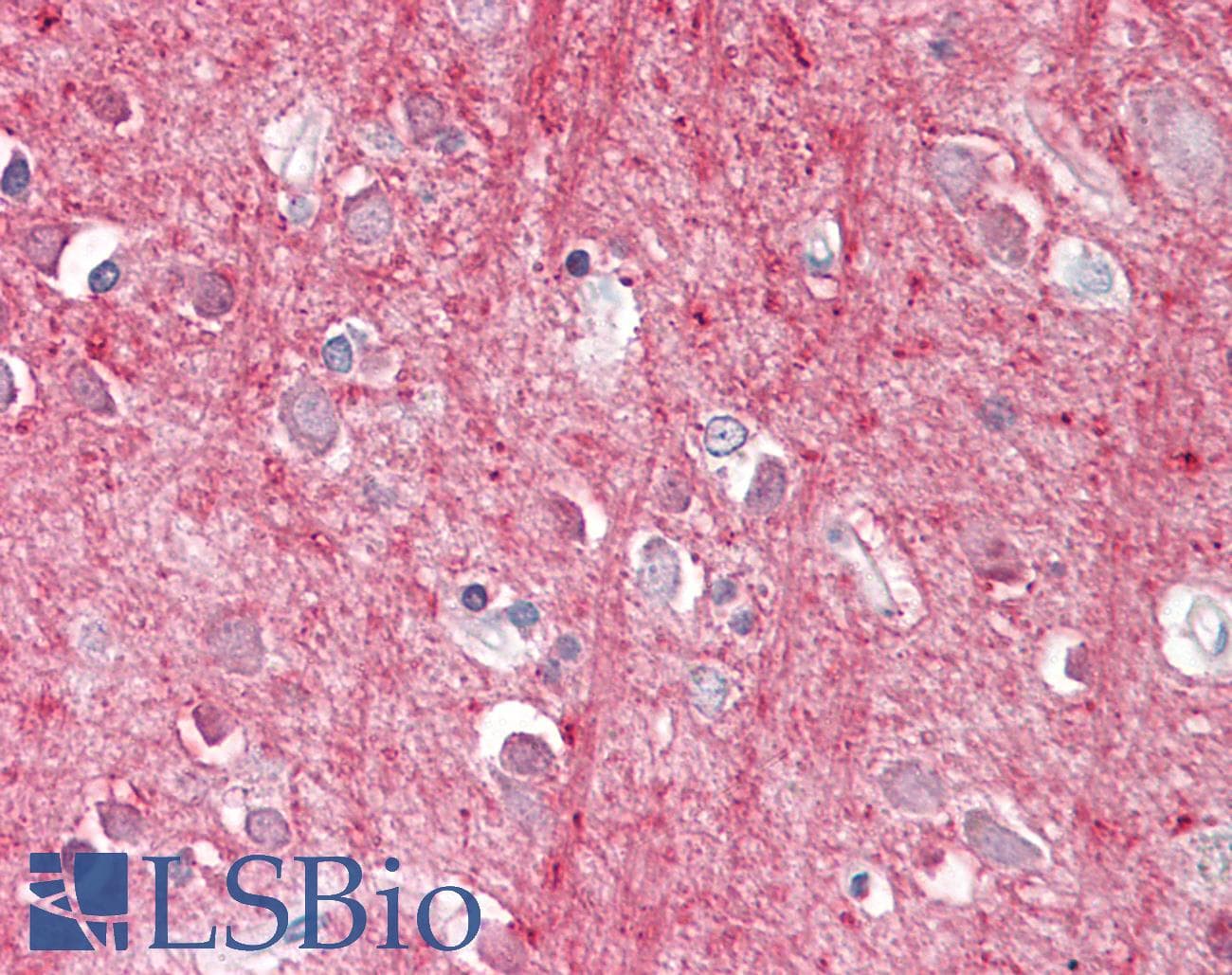 IHC-plus™ THY1 / CD90 Antibody (aa70-84)