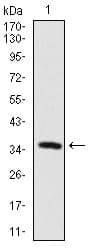 MAP2 Antibody (clone 5B7)