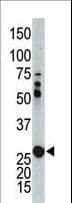Polyclonal Rabbit anti-Human AK2 / Adenylate Kinase 2 Antibody (aa1-30, IHC, WB)