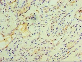 FOSL2 / FRA-2 Antibody (aa187-326)