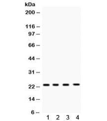 Polyclonal Rabbit anti-Human RAB7A / RAB7 Antibody (WB)