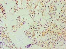 DFNA5 Antibody (aa1-260)
