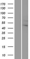 GNA12 Protein (Over-Expression Lysate Myc-DDK (Flag))