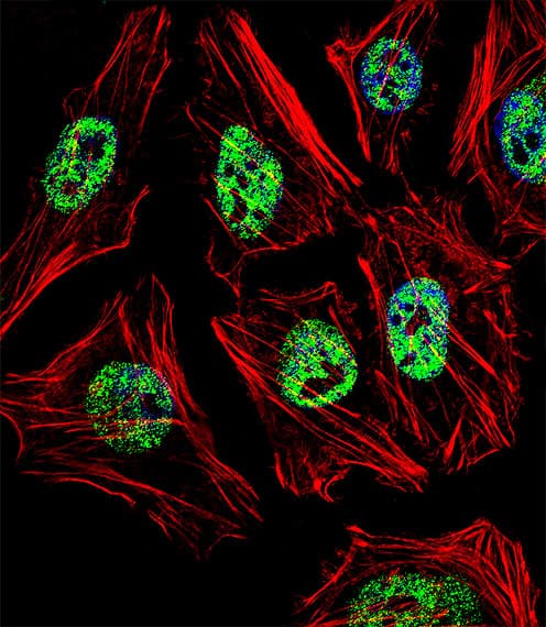 NANOG Antibody (aa15-49)