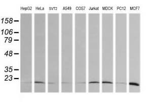 HRAS / H-Ras Antibody (clone OTI1C2)