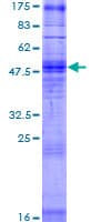 Human OR2T27 Protein (Recombinant GST)