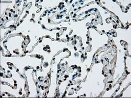 ERCC1 Antibody (clone OTI1A3)