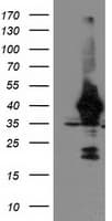 UNG / Uracil DNA Glycosylase Antibody (clone OTI2C12)
