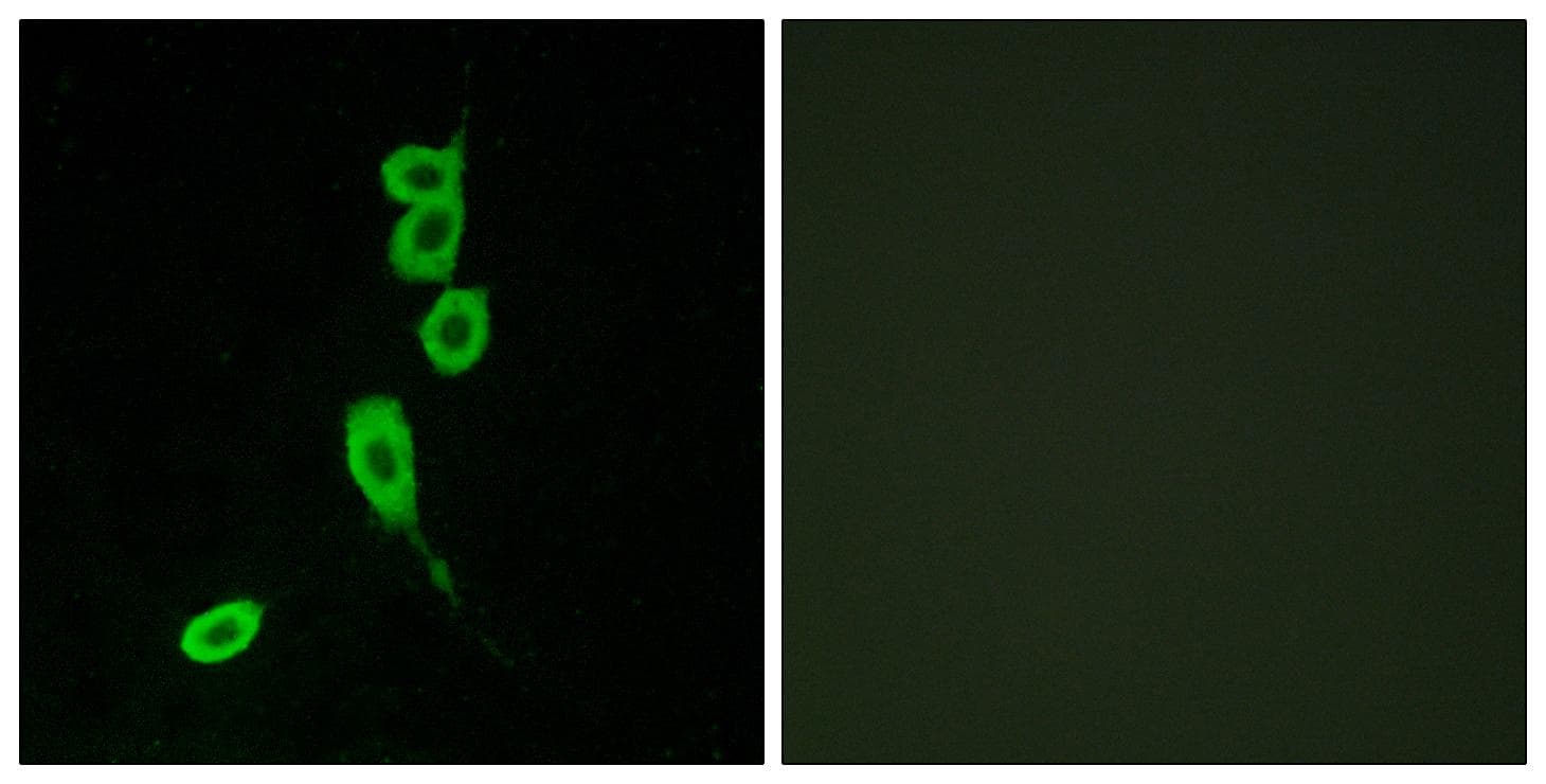 MC1R Antibody