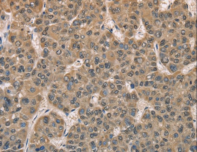 DACH2 Antibody