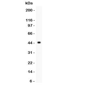 IKBKB / IKK2 / IKK Beta Antibody