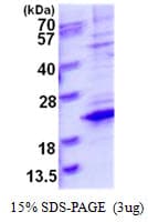 Human TCEAL8 Protein (Recombinant His)